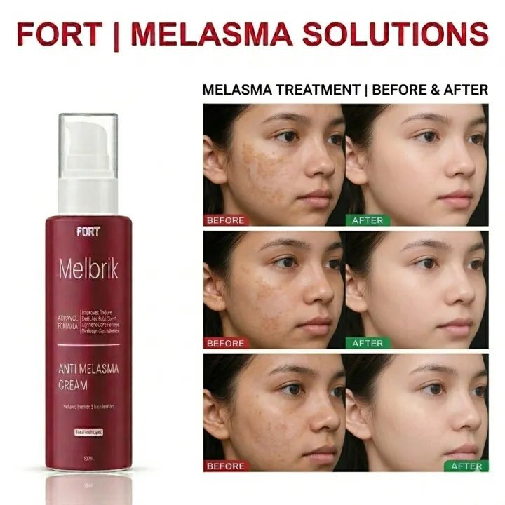 Fort Anti Melasma Cream (50ml)